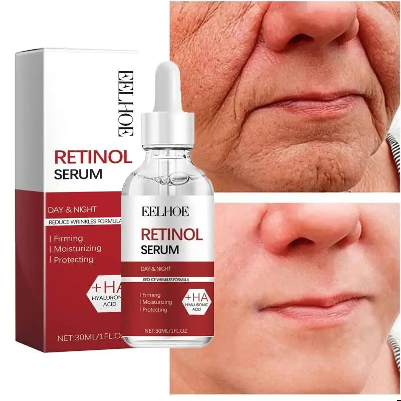 Retinol Wrinkle Remover Facial Set I Anti-Aging Serum I Instant Lifting